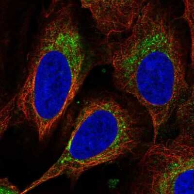 Immunocytochemistry/Immunofluorescence: DEGS1 Antibody [NBP2-57505] - Staining of human cell line U-2 OS shows localization to mitochondria.