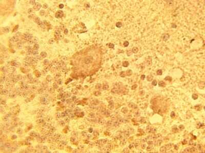 Immunohistochemistry: DEGS1 Antibody [NBP3-11921] - Immunohistochemical staining of normal human brain tissue using DEGS1 antibody at 15 ug/ml.