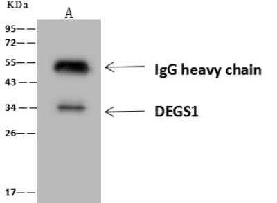 Immunoprecipitation: DEGS1 Antibody [NBP3-12689] - Lane A:0.5 mg 293T Whole Cell Lysate4 uL anti-DEGS1 rabbit polyclonal antibody and 60 ug of Immunomagnetic beads Protein A/G.Primary antibody:Anti-DEGS1 rabbit polyclonal antibody,at 1:100 dilution Secondary antibody:Goat Anti-Rabbit IgG (H+L)/HRP at 1/10000 dilutionDeveloped using the ECL technique.Performed under reducing conditions.Predicted band size: 38 kDaObserved band size :34 kDa