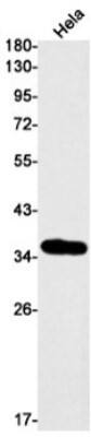 Western Blot: DEGS1 Antibody (S03-5D2) [NBP3-19964] - Western blot detection of DEGS1 in Hela cell lysates using NBP3-19964 (1:1000 diluted). Predicted band size: 38kDa. Observed band size: 38kDa.