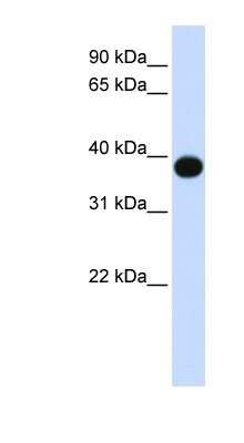 Western Blot: DEGS1 Antibody [NBP1-59941] - Human Muscle lysate, concentration 0.2-1 ug/ml.