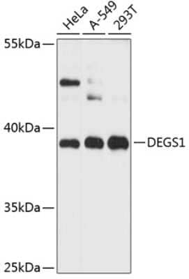 Western Blot: DEGS1 Antibody [NBP2-92082] - Analysis of extracts of various cell lines, using DEGS1 at 1:3000 dilution.Secondary antibody: HRP Goat Anti-Rabbit IgG (H+L) at 1:10000 dilution.Lysates/proteins: 25ug per lane.Blocking buffer: 3% nonfat dry milk in TBST.Detection: ECL Basic Kit .Exposure time: 10s.