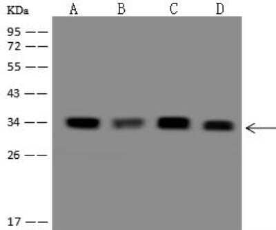 Western Blot: DEGS1 Antibody [NBP3-12689] - Lane A: 293T Whole Cell LysateLane B: HepG2 Whole Cell LysateLane C: U87-MG Whole Cell LysateLane D: 293 Whole Cell LysateLysates/proteins at 30 ug per lane.SecondaryGoat Anti-Rabbit IgG (H+L)/HRP at 1/10000 dilution.Developed using the ECL technique.Performed under reducing conditions.Predicted band size:38 kDaObserved band size:34 kDa