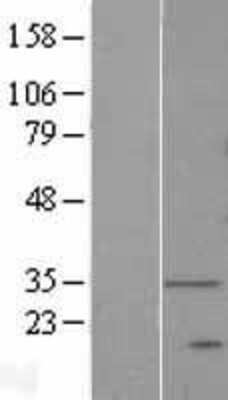 Western Blot: DEGS1 Overexpression Lysate (Adult Normal) [NBP2-07967] Left-Empty vector transfected control cell lysate (HEK293 cell lysate); Right -Over-expression Lysate for DEGS1.