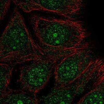 Immunocytochemistry/Immunofluorescence: DEGS2 Antibody [NBP2-13912] - Staining of human cell line MCF7 shows localization to nucleus & nucleoli.