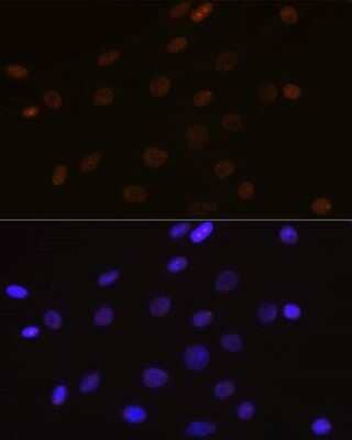 Immunocytochemistry/Immunofluorescence: DEK Antibody (2C2V8) [NBP3-15257] - Immunofluorescence analysis of C6 cells using DEK Rabbit mAb (NBP3-15257) at dilution of 1:100 (40x lens). Blue: DAPI for nuclear staining.