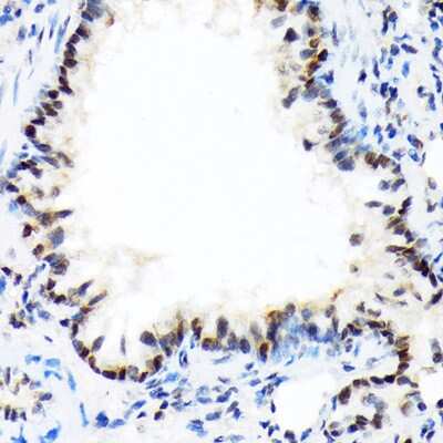 Immunohistochemistry-Paraffin: DEK Antibody (2C2V8) [NBP3-15257] - Immunohistochemistry of paraffin-embedded rat lung using DEK Rabbit mAb (NBP3-15257) at dilution of 1:100 (40x lens).Perform microwave antigen retrieval with 10 mM Tris/EDTA buffer pH 9.0 before commencing with IHC staining protocol.