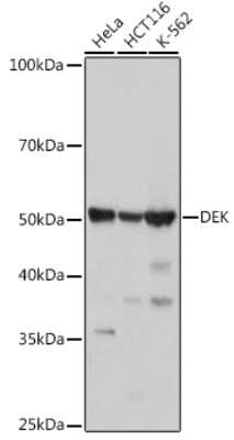 Western Blot: DEK Antibody (2C2V8) [NBP3-15257] - Western blot analysis of extracts of various cell lines, using DEK antibody (NBP3-15257) at 1:1000 dilution. Secondary antibody: HRP Goat Anti-Rabbit IgG (H+L) at 1:10000 dilution. Lysates/proteins: 25ug per lane. Blocking buffer: 3% nonfat dry milk in TBST. Detection: ECL Basic Kit. Exposure time: 3s.