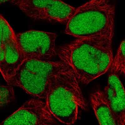 Immunocytochemistry/Immunofluorescence: DEK Antibody [NBP2-38834] - Immunofluorescent staining of human cell line RH-30 shows localization to nucleus.