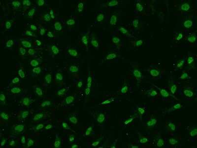 Immunocytochemistry/Immunofluorescence: DEK Antibody [NBP2-97614] - Immunofluorescence staining of DEK in Hela cells. Cells were fixed with 4% PFA, permeabilzed with 0.1% Triton X-100 in PBS, blocked with 10% serum, and incubated with rabbit anti-Human DEK polyclonal antibody (dilution ratio 1:100) at 4C overnight. Then cells were stained with the Alexa Fluor(R)488-conjugated Goat Anti-rabbit IgG secondary antibody (green). Positive staining was localized to Nucleus.