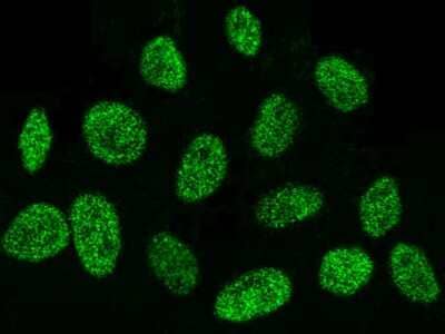 Immunocytochemistry/Immunofluorescence: DEK Antibody [NBP2-98888] - Immunofluorescence staining of DEK in Hela cells. Cells were fixed with 4% PFA, permeabilzed with 0.3% Triton X-100 in PBS, blocked with 10% serum, and incubated with rabbit anti-Human DEK polyclonal antibody (dilution ratio 1:5000) at 4C overnight. Then cells were stained with the Alexa Fluor$488-conjugated Goat Anti-rabbit IgG secondary antibody (green). Positive staining was localized to nucleus.