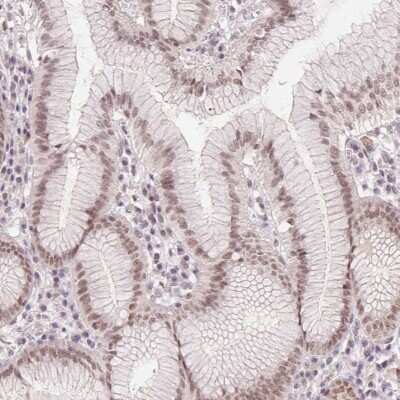 Immunohistochemistry: DEK Antibody [NBP2-49135] - Staining of human stomach shows moderate nuclear positivity in glandular cells.