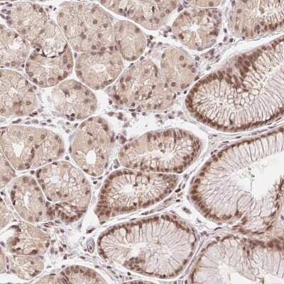 Immunohistochemistry-Paraffin: DEK Antibody [NBP2-38834] - Staining of human stomach shows moderate nuclear positivity in glandular cells.