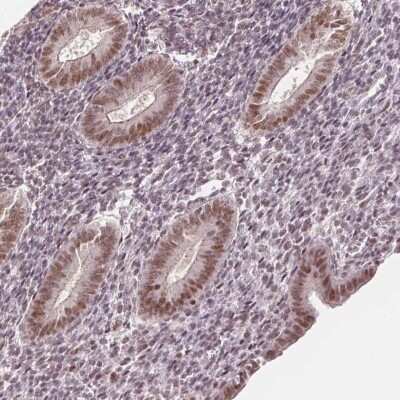 Immunohistochemistry-Paraffin: DEK Antibody [NBP2-49135] - Staining of human endometrium shows high expression.