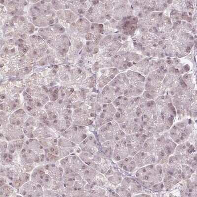 Immunohistochemistry-Paraffin: DEK Antibody [NBP2-49135] - Staining of human pancreas shows low expression as expected.