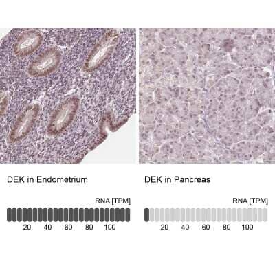 <b>Orthogonal Strategies Validation. </b>Immunohistochemistry-Paraffin: DEK Antibody [NBP2-49135] - Staining in human endometrium and pancreas tissues using anti-DEK antibody. Corresponding DEK RNA-seq data are presented for the same tissues.