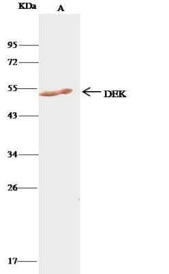 Immunoprecipitation: DEK Antibody [NBP2-98888] - Lane A:0.5 mg K562 Whole Cell Lysate1 uL anti-DEK rabbit polyclonal antibody and 15 ul of 50 % Protein G agarose.Primary antibody:Anti-DEK rabbit polyclonal antibody,at 1:500 dilution Secondary antibody:Clean-Bloto IP Detection Reagent (HRP) at 1:500 dilutionDeveloped using the DAB staining technique.Performed under reducing conditions.Predicted band size: 42 kDaObserved band size: 42 kDa