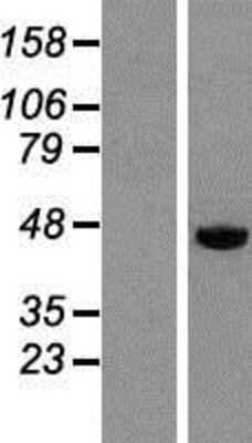 Western Blot: DEK Overexpression Lysate (Adult Normal) [NBP2-08003] Left-Empty vector transfected control cell lysate (HEK293 cell lysate); Right -Over-expression Lysate for DEK.