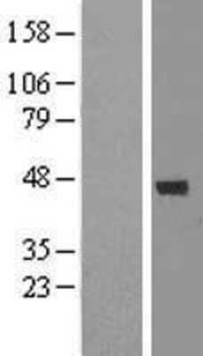 Western Blot: DEM1 Overexpression Lysate (Adult Normal) [NBL1-08304] Left-Empty vector transfected control cell lysate (HEK293 cell lysate); Right -Over-expression Lysate for DEM1.