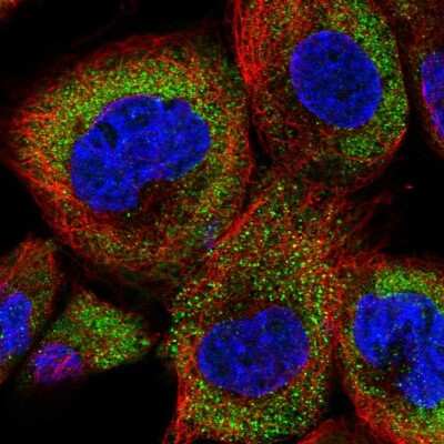 Immunocytochemistry/Immunofluorescence: DENN/MADD Domain Containing 2D Antibody [NBP2-30448] - Immunofluorescent staining of human cell line A-431 shows localization to cytosol.