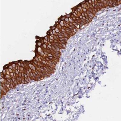 Immunohistochemistry DENN/MADD Domain Containing 2D Antibody - BSA Free