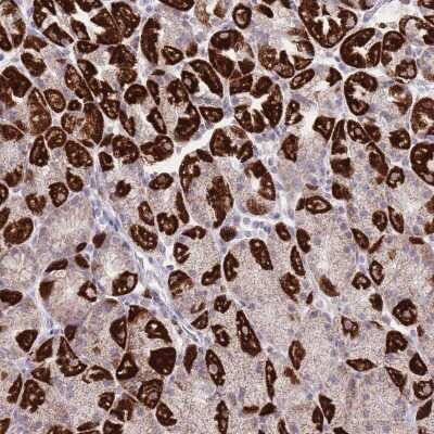 Immunohistochemistry-Paraffin: DENN/MADD Domain Containing 2D Antibody [NBP2-30448] - Staining of human stomach, lower shows strong cytoplasmic positivity in subset of glandular cells.