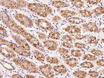Immunohistochemistry-Paraffin: DENN/MADD Domain Containing 2D Antibody [NBP2-97542] - Immunochemical staining of human DENN/MADD Domain Containing 2D in human stomach with rabbit polyclonal antibody at 1:200 dilution, formalin-fixed paraffin embedded sections.