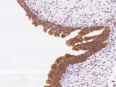 Immunohistochemistry-Paraffin: DENN/MADD Domain Containing 2D Antibody [NBP2-97542] - Immunochemical staining of human DENN/MADD Domain Containing 2D in human urinary bladder with rabbit polyclonal antibody at 1:200 dilution, formalin-fixed paraffin embedded sections.