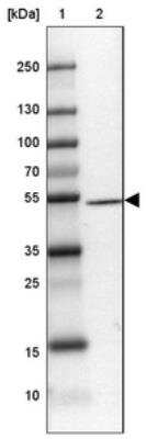 Western Blot DENN/MADD Domain Containing 2D Antibody - BSA Free
