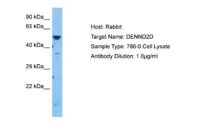 Western Blot: DENN/MADD Domain Containing 2D Antibody [NBP2-84771] - Host: Rabbit. Target Name: DENND2D. Sample Tissue: Human 786-0 Whole Cell. Antibody Dilution: 1.0ug/ml