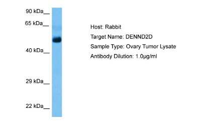 Western Blot: DENN/MADD Domain Containing 2D Antibody [NBP2-84772] - Host: Rabbit. Target Name: DENND2D. Sample Tissue: Human Ovary Tumor lysates. Antibody Dilution: 1ug/ml