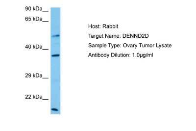 Western Blot: DENN/MADD Domain Containing 2D Antibody [NBP2-84773] - Host: Rabbit. Target Name: DENND2D. Sample Tissue: Human Ovary Tumor lysates. Antibody Dilution: 1ug/ml