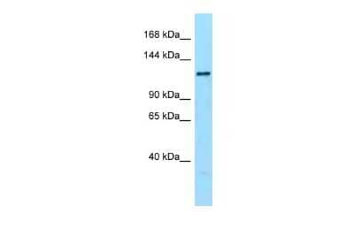 Western Blot: DENND1A Antibody [NBP2-84001] - WB Suggested Anti-Dennd1a Antibody. Titration: 1.0 ug/ml. Positive Control: Mouse Heart