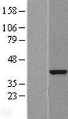 Western Blot: DENND1B Overexpression Lysate (Adult Normal) [NBL1-08314] Left-Empty vector transfected control cell lysate (HEK293 cell lysate); Right -Over-expression Lysate for DENND1B.