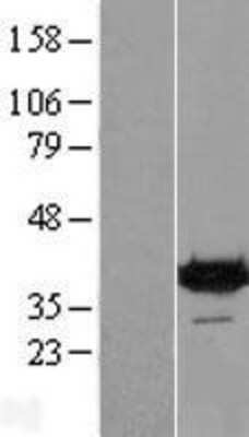 Western Blot: DENND1B Overexpression Lysate (Adult Normal) [NBP2-05522] Left-Empty vector transfected control cell lysate (HEK293 cell lysate); Right -Over-expression Lysate for DENND1B.