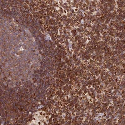 Immunohistochemistry: DENND1C Antibody [NBP1-94051] - Staining of human lymph node shows strong cytoplasmic positivity in non-germinal center cells.