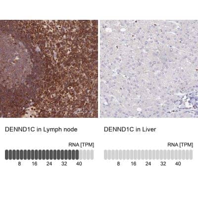 <b>Orthogonal Strategies Validation. </b>Immunohistochemistry-Paraffin: DENND1C Antibody [NBP1-94051] - Staining in human lymph node and liver tissues using anti-DENND1C antibody. Corresponding DENND1C RNA-seq data are presented for the same tissues.