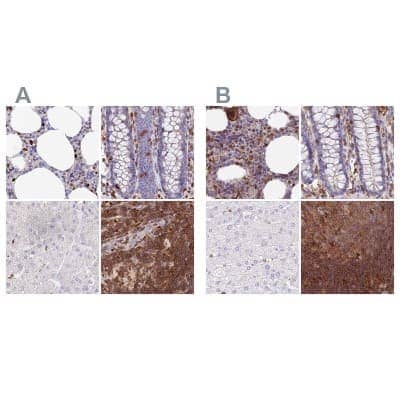 <b>Independent Antibodies Validation. </b>Immunohistochemistry-Paraffin: DENND1C Antibody [NBP1-94051] - Staining of human bone marrow, colon, liver and lymph node using Anti-DENND1C antibody NBP1-94051 (A) shows similar protein distribution across tissues to independent antibody NBP1-94052 (B).