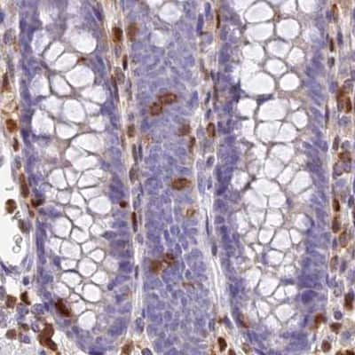 Immunohistochemistry-Paraffin: DENND1C Antibody [NBP1-94051] - Staining of human colon.