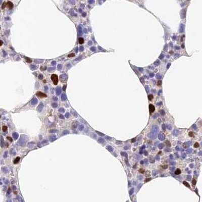 Immunohistochemistry-Paraffin: DENND1C Antibody [NBP1-94051] - Staining of human bone marrow.