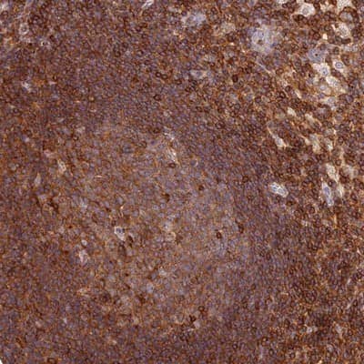 Immunohistochemistry-Paraffin: DENND1C Antibody [NBP1-94052] - Staining of human lymph node shows strong cytoplasmic positivity in germinal center cells and non-germinal center cells.