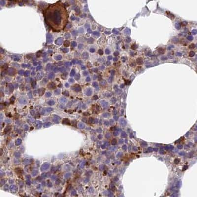 Immunohistochemistry-Paraffin: DENND1C Antibody [NBP1-94052] - Staining of human bone marrow.