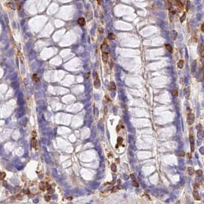 Immunohistochemistry-Paraffin: DENND1C Antibody [NBP1-94052] - Staining of human colon.