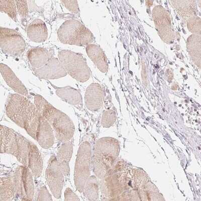 Immunohistochemistry-Paraffin: DENND2C Antibody [NBP2-49159] - Staining of human skeletal muscle shows cytoplasmic positivity in myocytes.