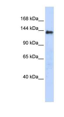 Western Blot DENND2C Antibody - BSA Free