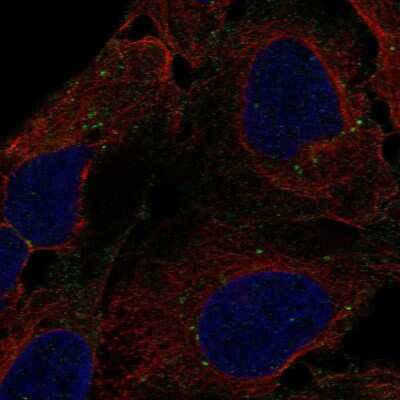 Immunocytochemistry/ Immunofluorescence DENND3 Antibody