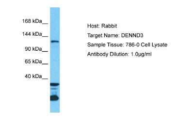 Western Blot: DENND3 Antibody [NBP2-84774] - Host: Rabbit. Target Name: DENND3. Sample Type: 786-0 Whole Cell lysates. Antibody Dilution: 1.0ug/ml