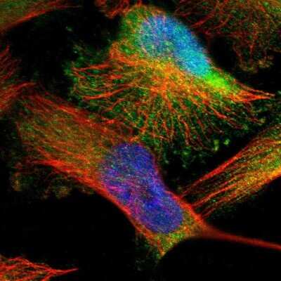 Immunocytochemistry/ Immunofluorescence DENND4C Antibody - BSA Free
