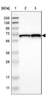 Western Blot DENND4C Antibody - BSA Free
