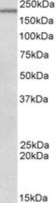 Western Blot: DENND4C Antibody [NBP2-27475] - (0.5 ug/ml) staining of Mouse Spleen lysate (35 ug protein in RIPA buffer). Primary incubation was 1 hour. Detected by chemiluminescence.
